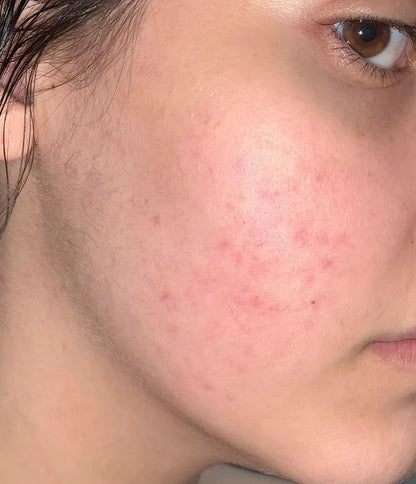 Advanced Niacinamide Brightening Serum